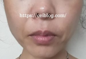 ナノアNANOAヒト幹細胞クレンジングオイルメイク落とし口コミレビュー