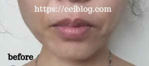 ナノア美溶液NANOAヒト幹細胞美容液口コミレビュー
