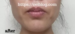 ナノア美溶液NANOAヒト幹細胞美容液口コミレビュー