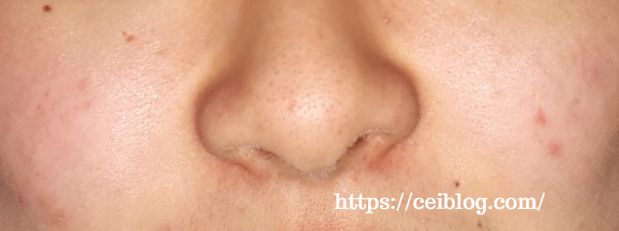 ナノアNANOA酵素洗顔パウダー 口コミ レビュー効果と使い方