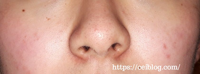 ナノアNANOA酵素洗顔パウダー 口コミ レビュー効果と使い方